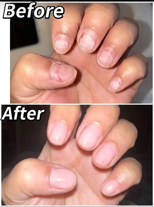 Nail repair and maintenance service